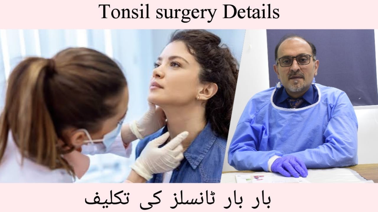 Tonsil Surgery